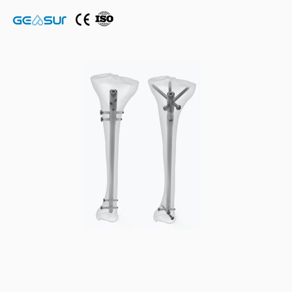 Geasure CE & ISO Certified Class III Titanium Alloy Interlocking Intramedullary Nail-Adult Orthopedic Trauma Implant