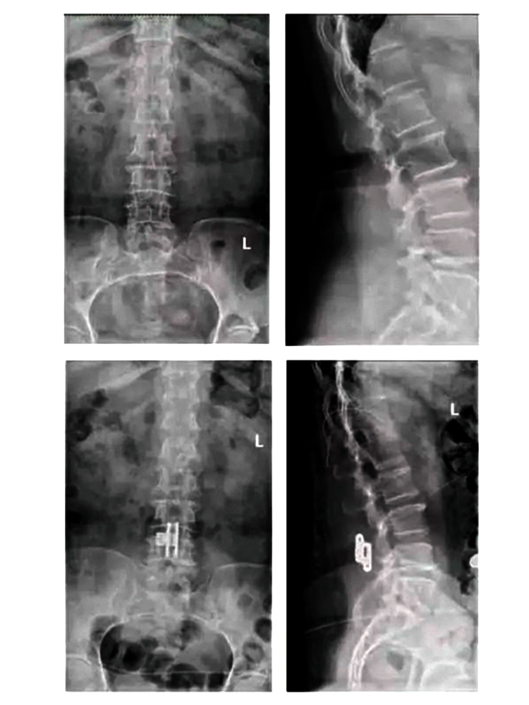 Case 1