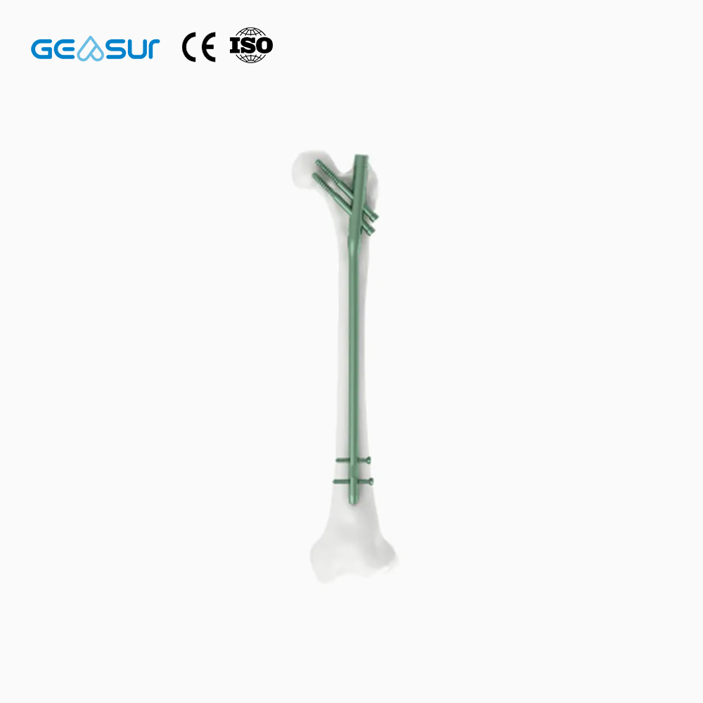 Geasure CE & ISO Certified Class III Titanium Alloy Interlocking Intramedullary Nail-Adult Orthopedic Trauma Implant