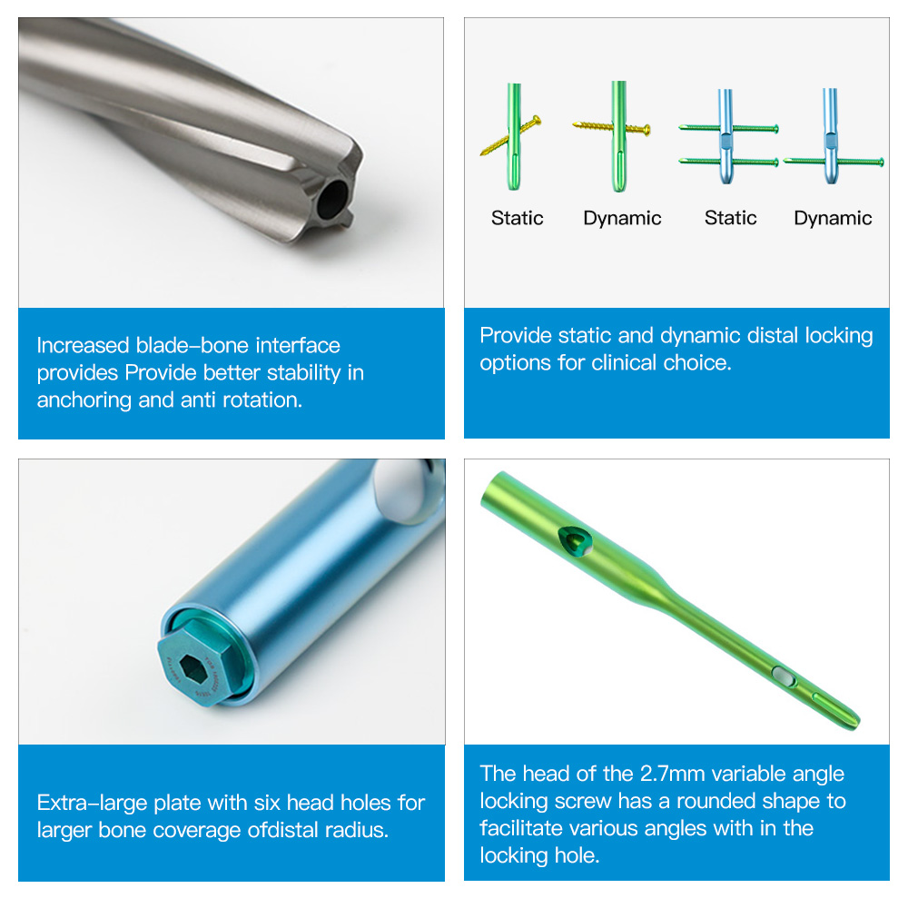 Geasure Femur InterlockingIintramedullary Nail PFNA Intramedullary Nail System for Orthopedic Surgey