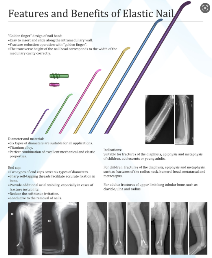 Elastic Nail view 1