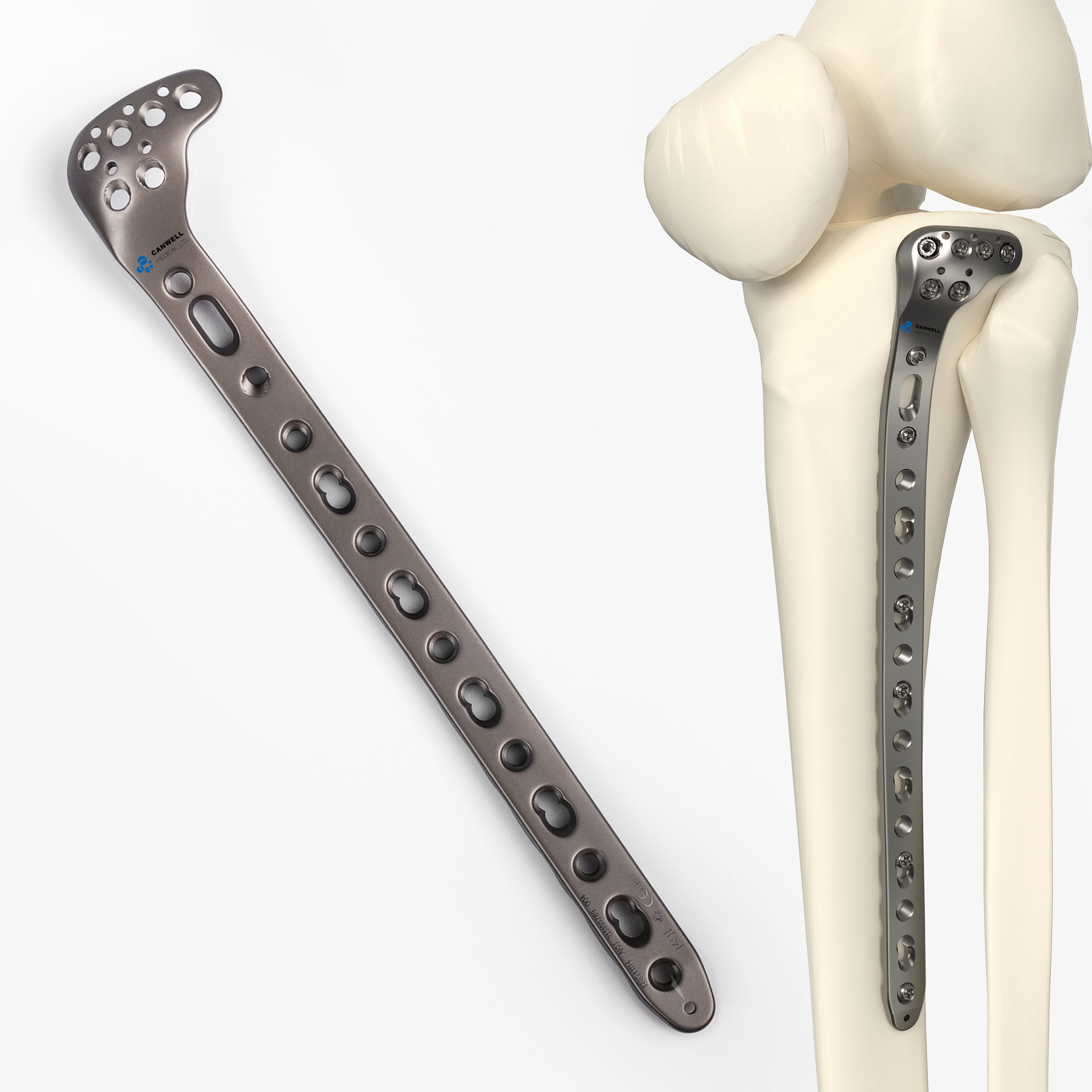 CANWELL Titanium Proximal Tibial Locking Plate Orthopedic Implant Trauma Fracture Fixation Bone Surgery System Class III
