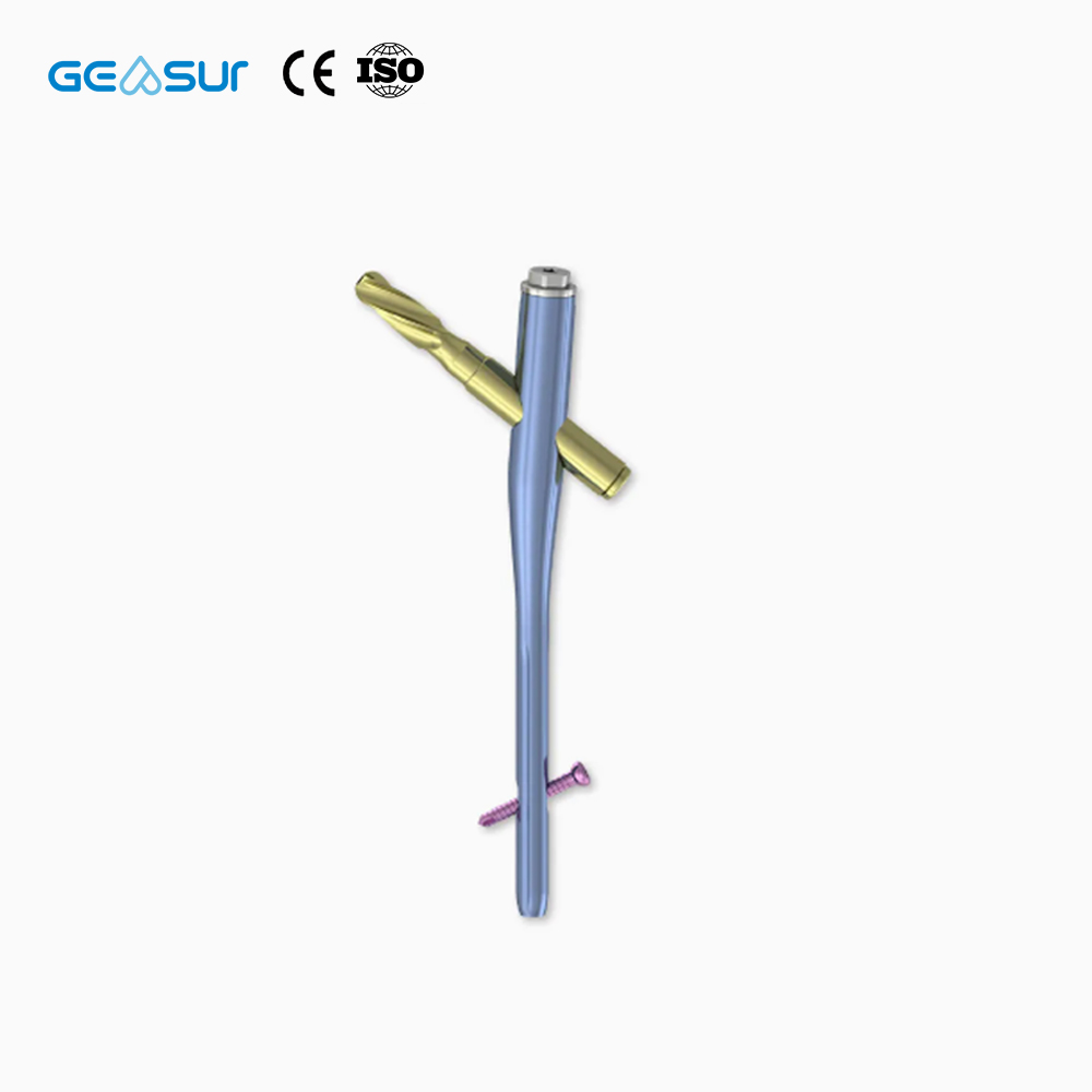 Geasure Premium Interlocking Intramedullary Nail-High Quality Class III Orthopedic Implant for Hospital Use Fracture Fixation 1