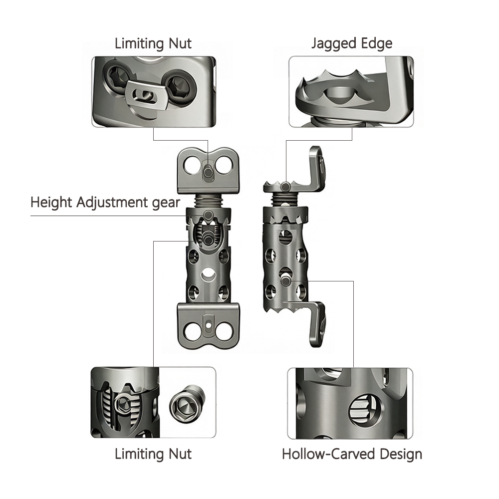 Geasure Medical-Grade Titanium Alloy Expandable Cage Is Used in Cervical Interbody fusion Surgery