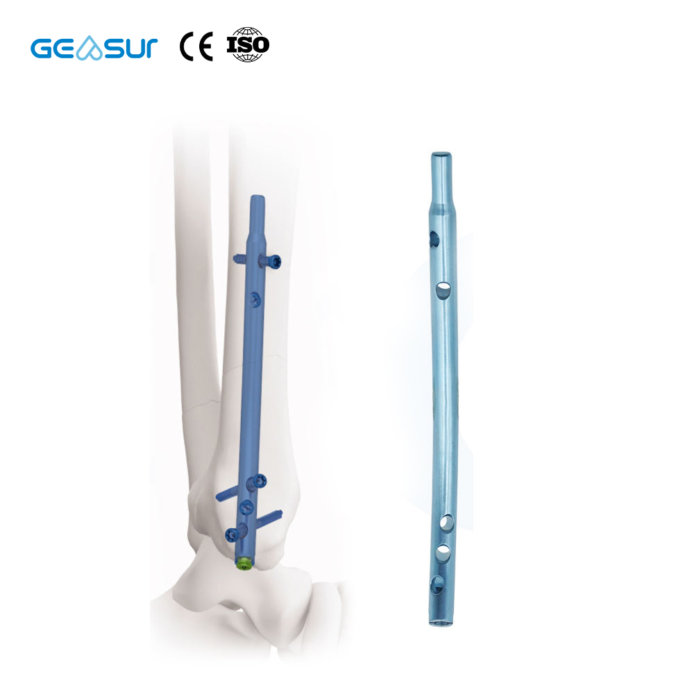 Geasure Retrograde Tibial Intramedullary Nail Instrument Set-Orthopedic Surgical Kit for Tibial Fracture Fixation Hospital Use