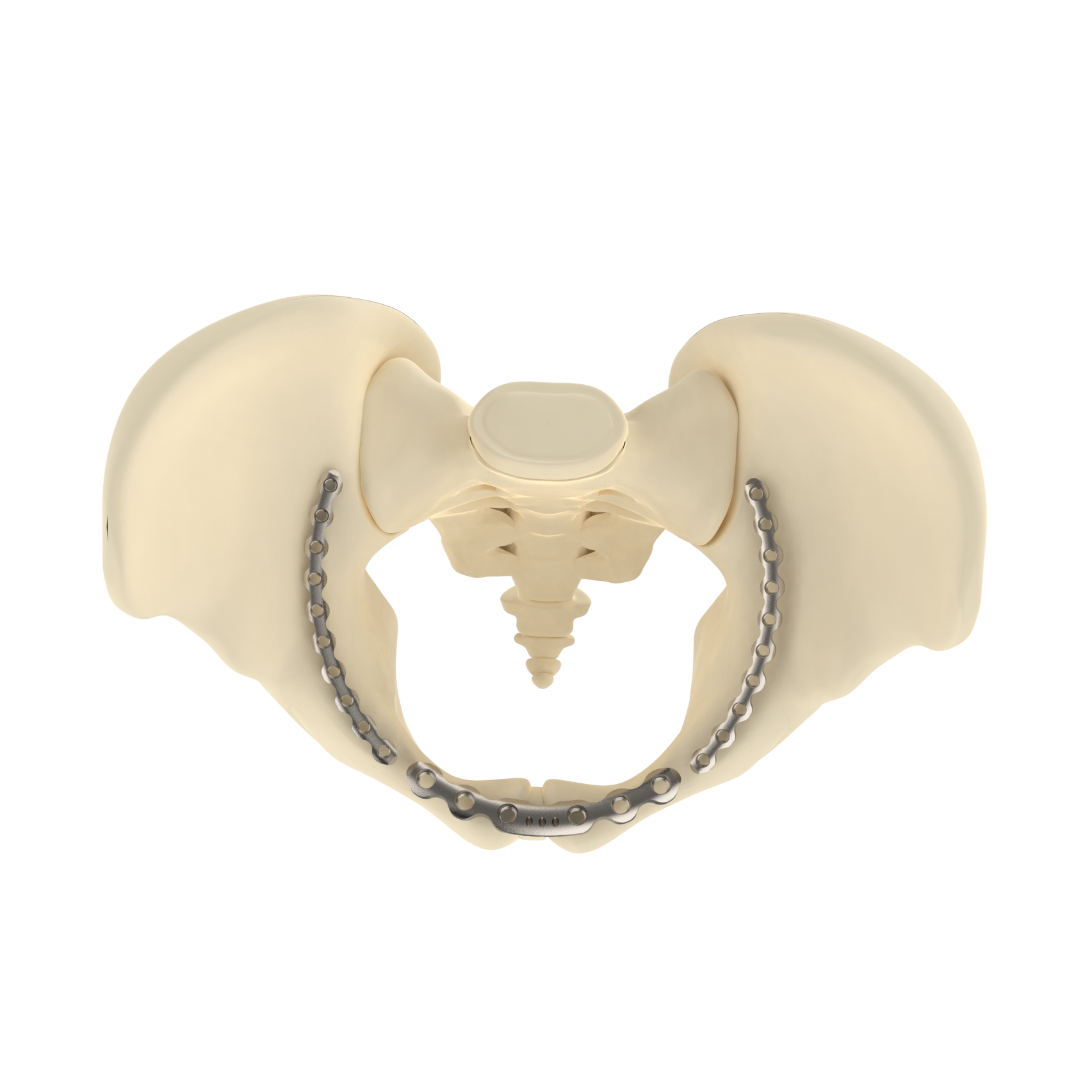 CANWELL CE/ISO Certified Stainless Steel Orthopedic Trauma 3.5mm Pelvic Locking Plate Curved Bone Fixation Implant Anatomical