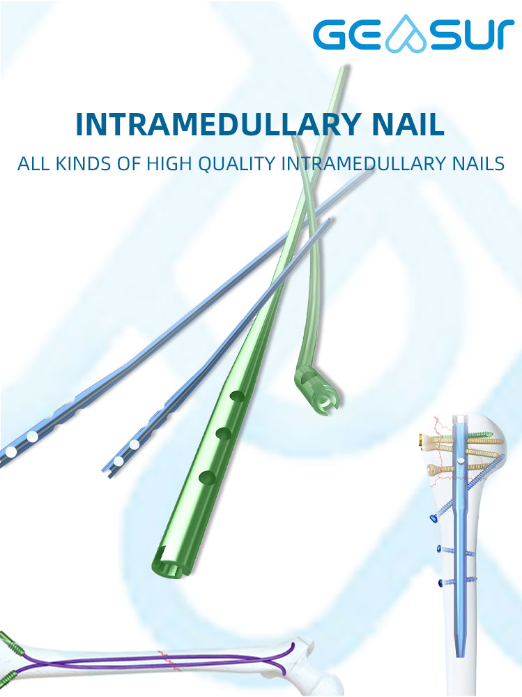 Intramedullary Nail System