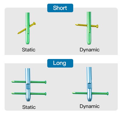 Distal Locking
