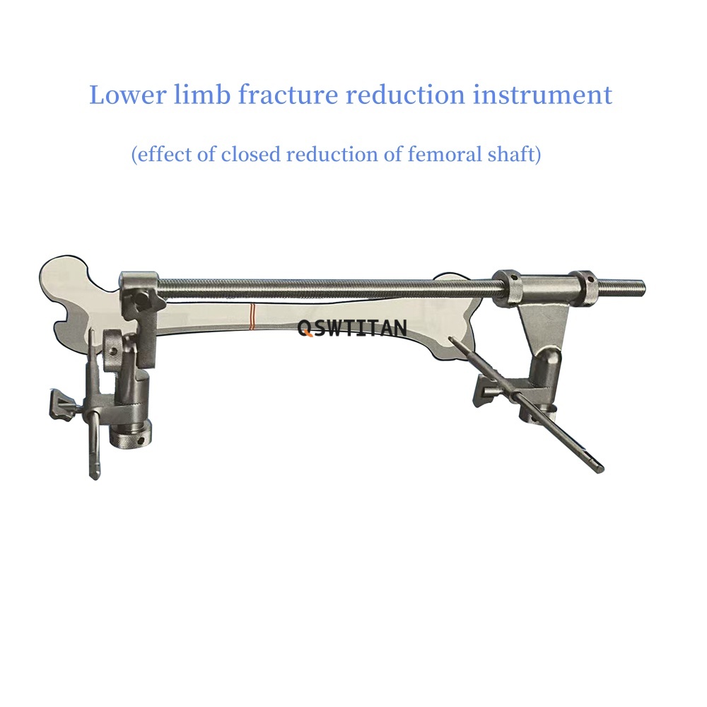 Stainless Steel Orthopedic Fracture Reduction Instrument Kit Fracture Femur Distractor Orthopedic Instrument