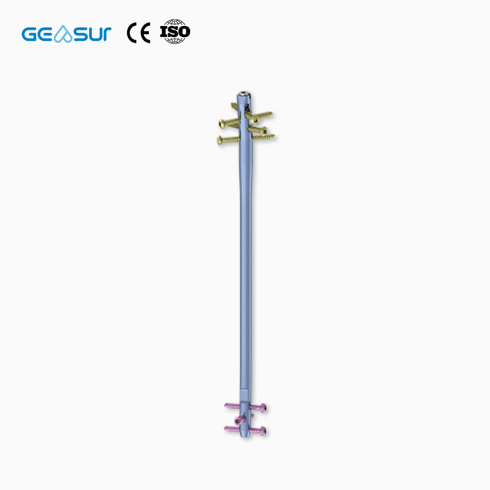 Geasure Premium Interlocking Intramedullary Nail-High Quality Class III Orthopedic Implant for Hospital Use Fracture Fixation 1