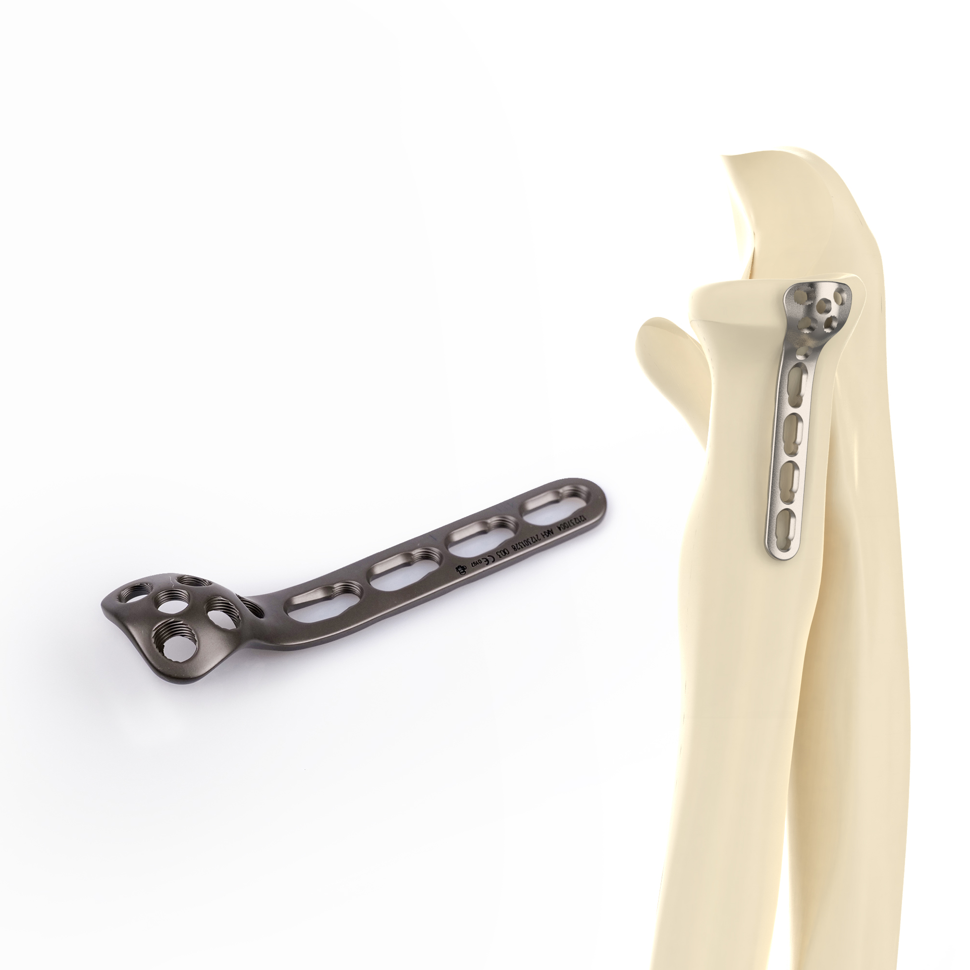 CANWELL Titanium Distal Radius Locking Plate (Fibula) Extra Long Two Column Variable Volar 3-Hole 2.4mm Class III CE Implant