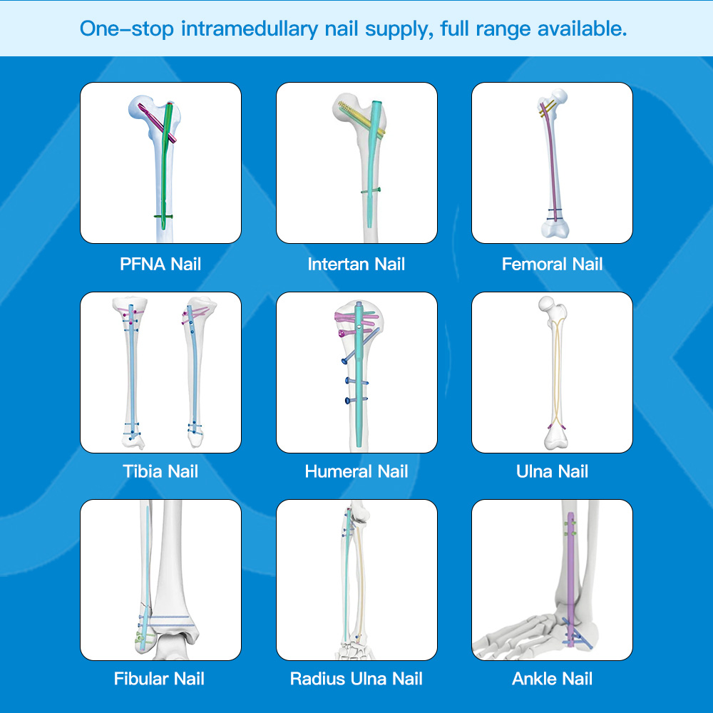 Geasure Titanium Intramedullary Nail 5.0/6.0 Locking Screw-Class III 1-Year Warranty for Ankle Tibial Fracture Fixation