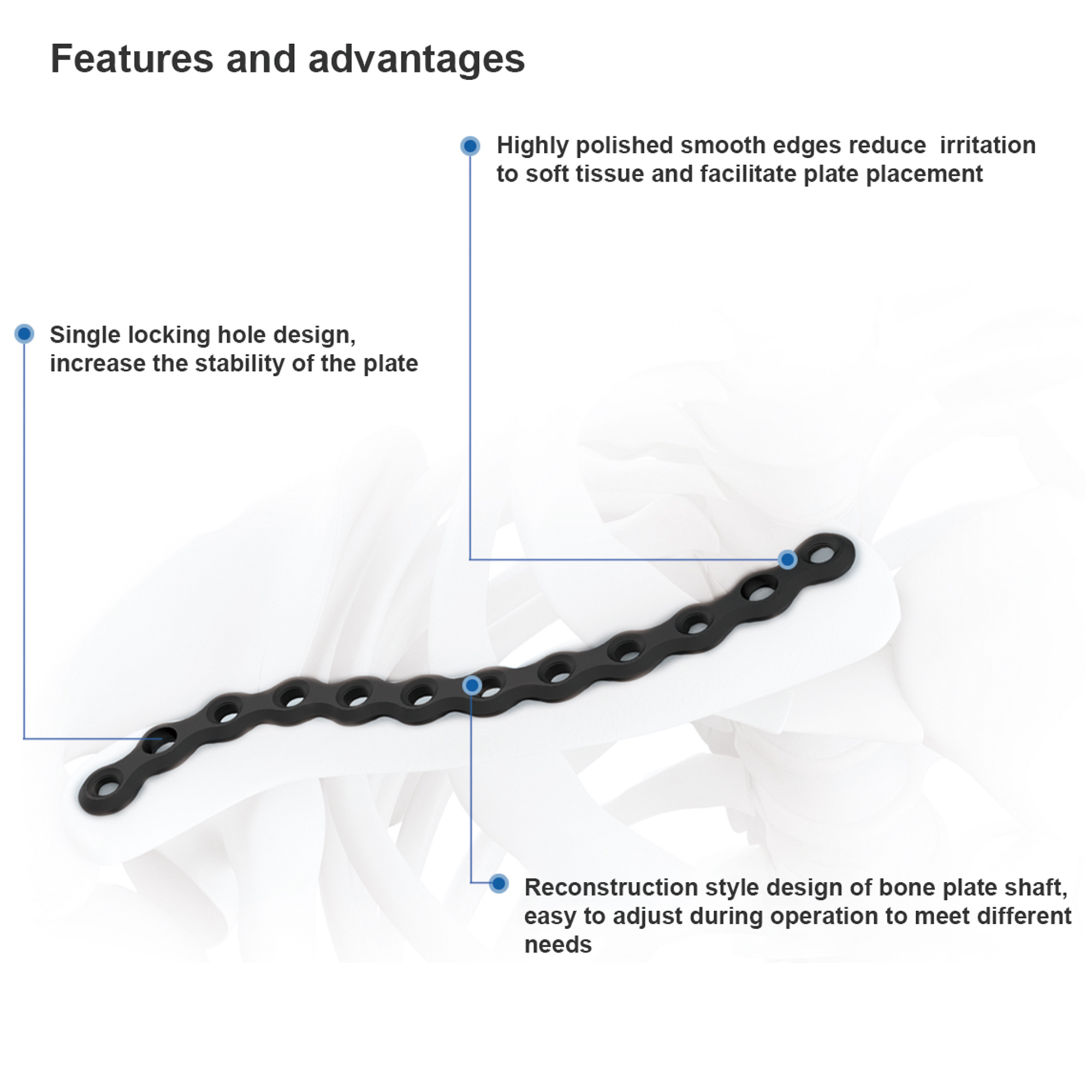 CANWELL Clavicle Locking Plate Titanium 2.7/3.5 mm Superior Anterior Orthopedic Bone Implant Fracture Repair Surgical