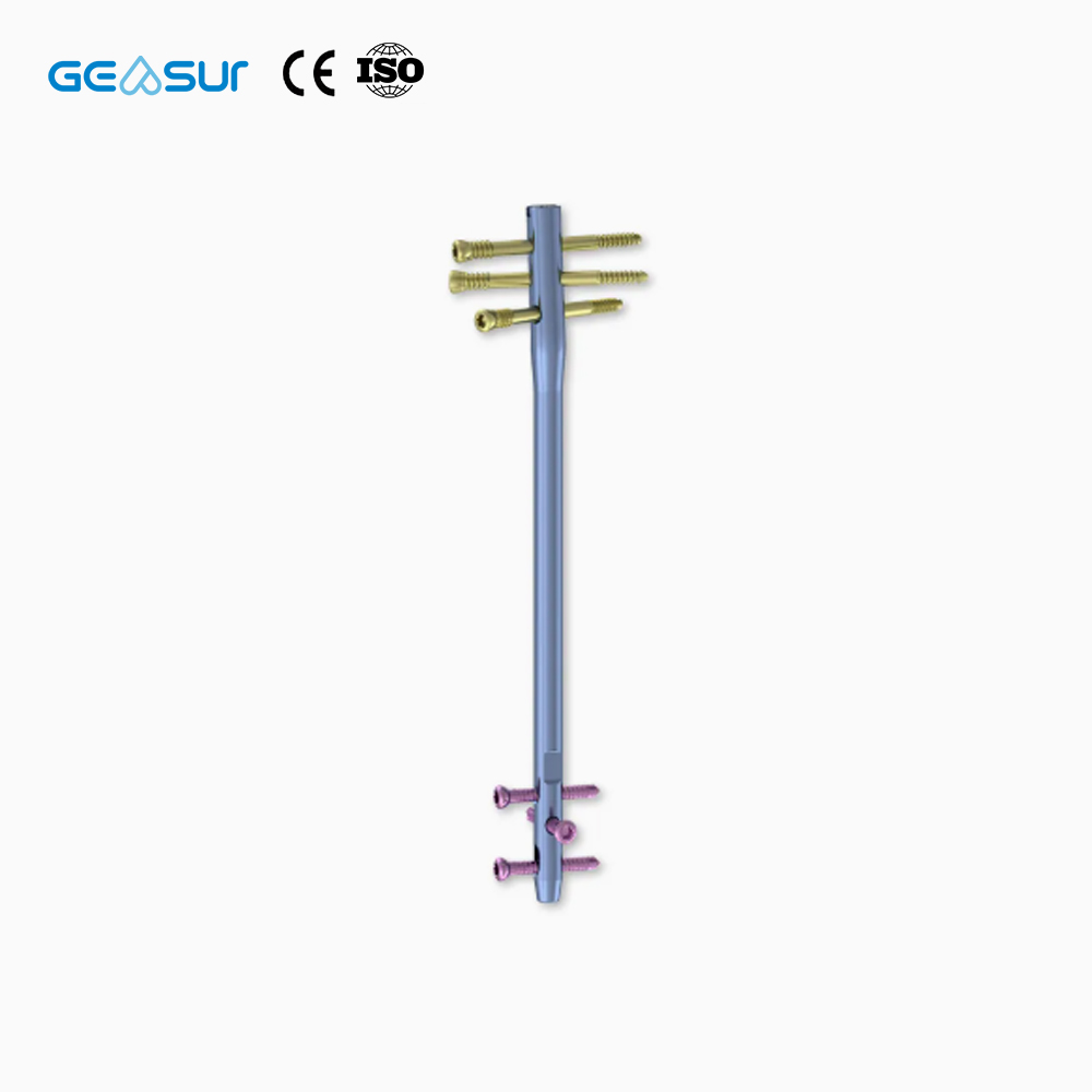 Geasure Premium Interlocking Intramedullary Nail-High Quality Class III Orthopedic Implant for Hospital Use Fracture Fixation 1