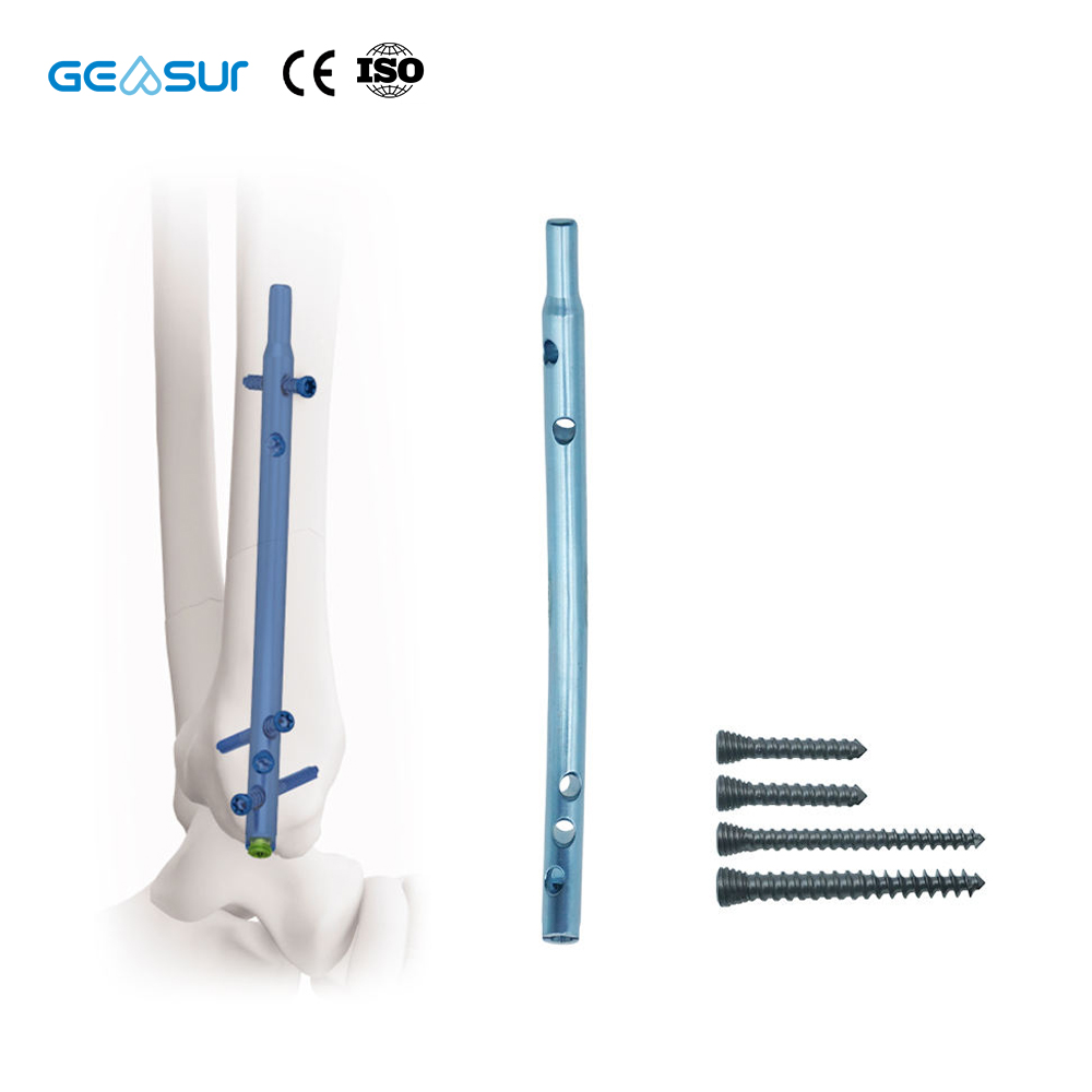 Geasure Retrograde Tibial Intramedullary Nail Instrument Set-Orthopedic Surgical Kit for Tibial Fracture Fixation Hospital Use