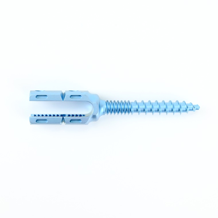 Factory Price Hot Selling High Quality Orthopedic Surgical Spinal Titanium Pedicle Screws for Spine Surgery
