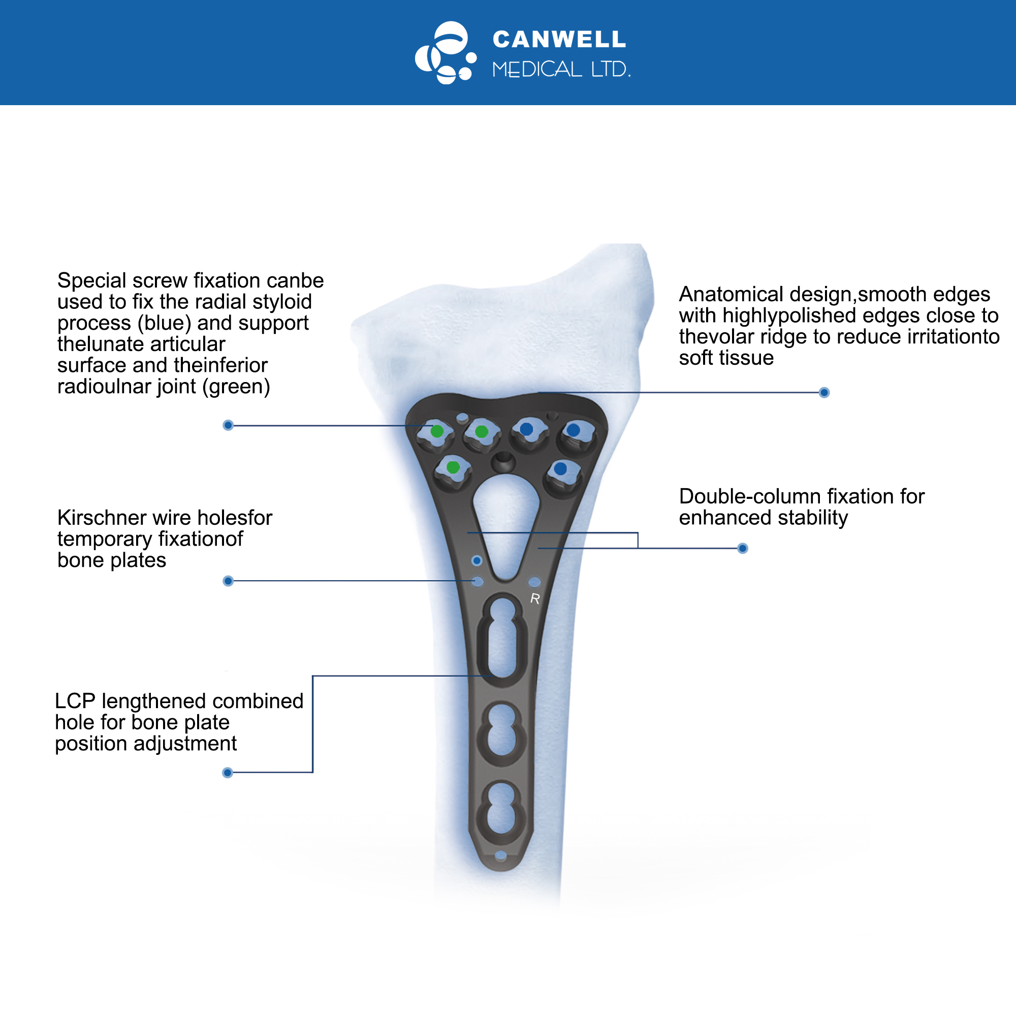 CANWELL Distal Radius TItanium Locking Plate Volar Wrist Orthopedic Trauma Implant Bone Fracture Suppliers Manufacturer CE ISO