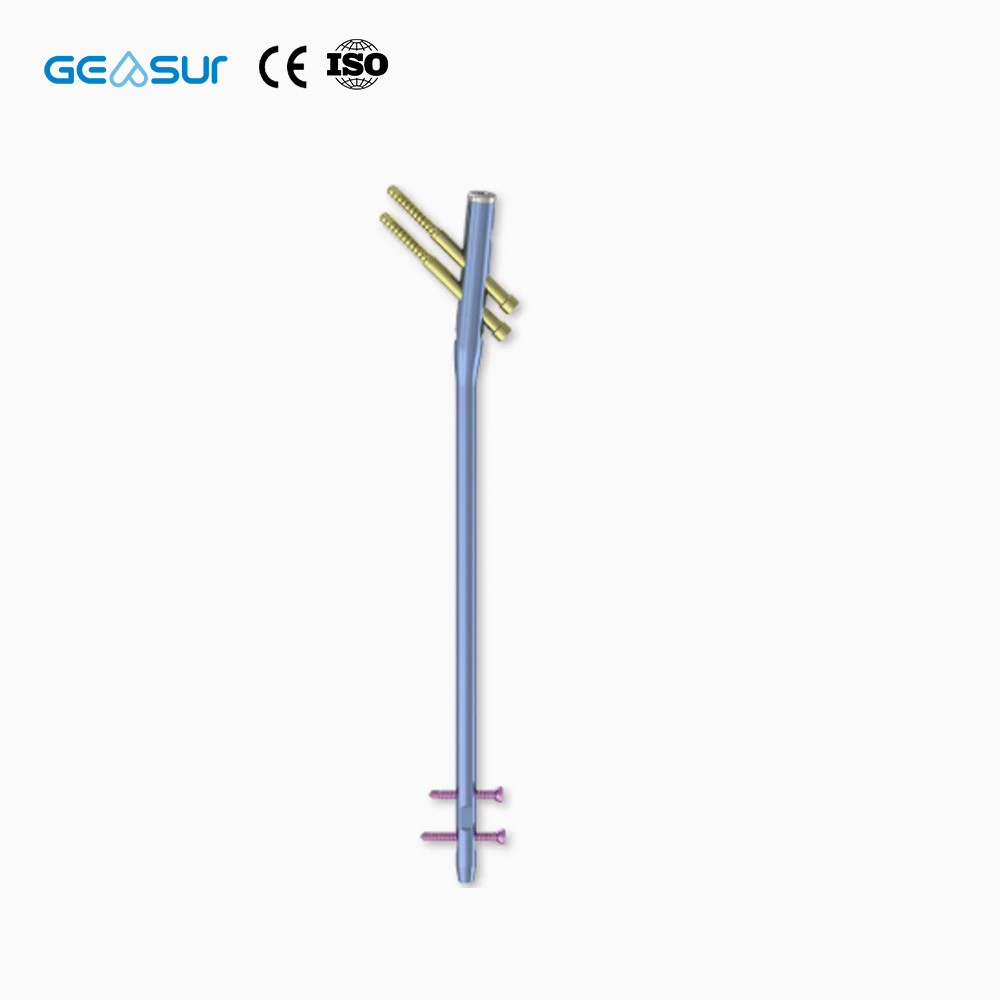 Geasure Premium Interlocking Intramedullary Nail-High Quality Class III Orthopedic Implant for Hospital Use Fracture Fixation 1