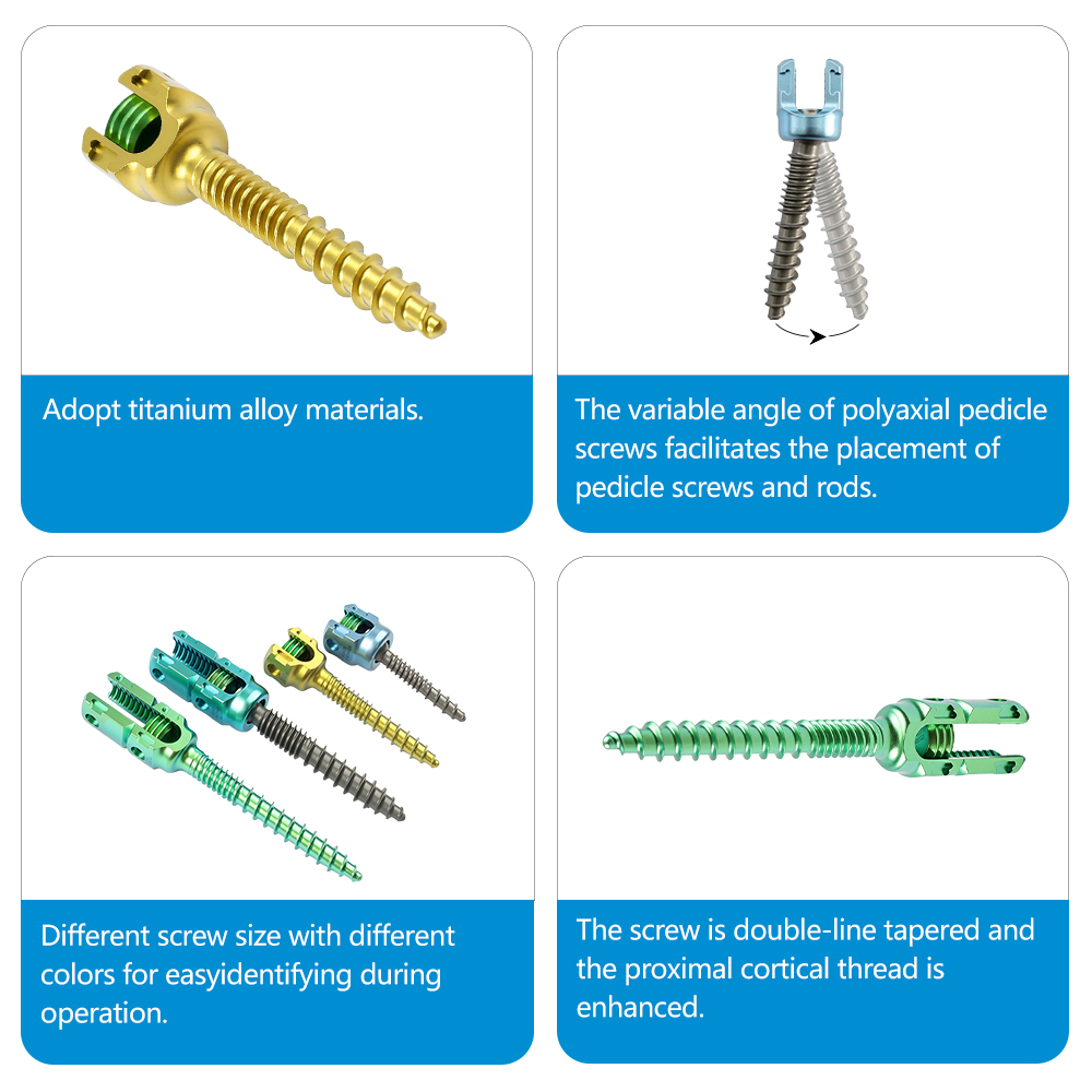 Wholesale Medical 5.5 Spine Titanium Pedicle Screws System for Surgery High Strength Titanium Alloy Spinal Screw Implant