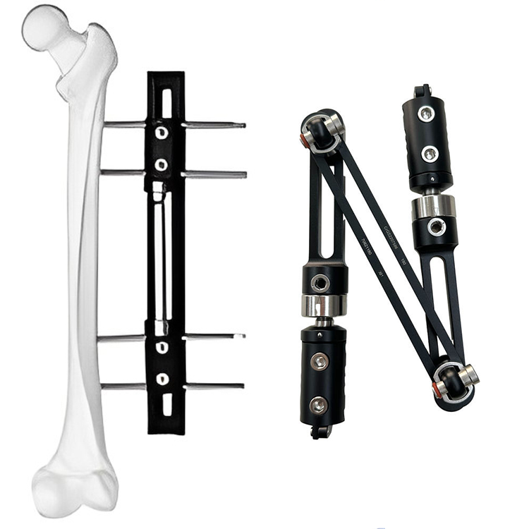 Assured Quality External Fixation Device Orthopedic Surgical Instruments Knee Joint External Fixator Orthopedic Surgical Fixator