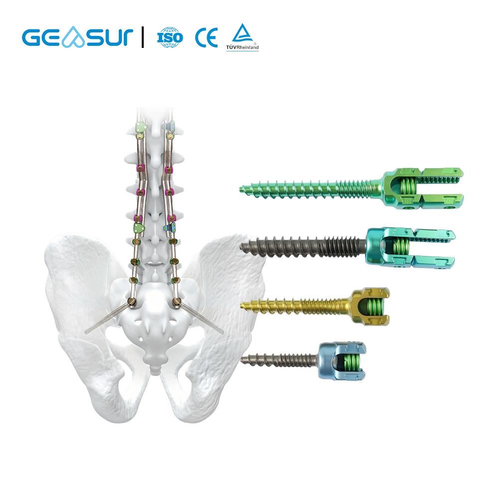 High-Quality Orthopedic Implant: Titanium Alloy ValuFix 5.5 Spinal Pedicle Screw System