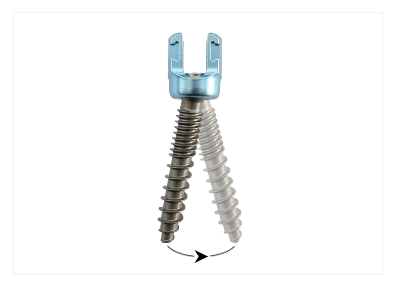 Polyaxial Pedicle Screws