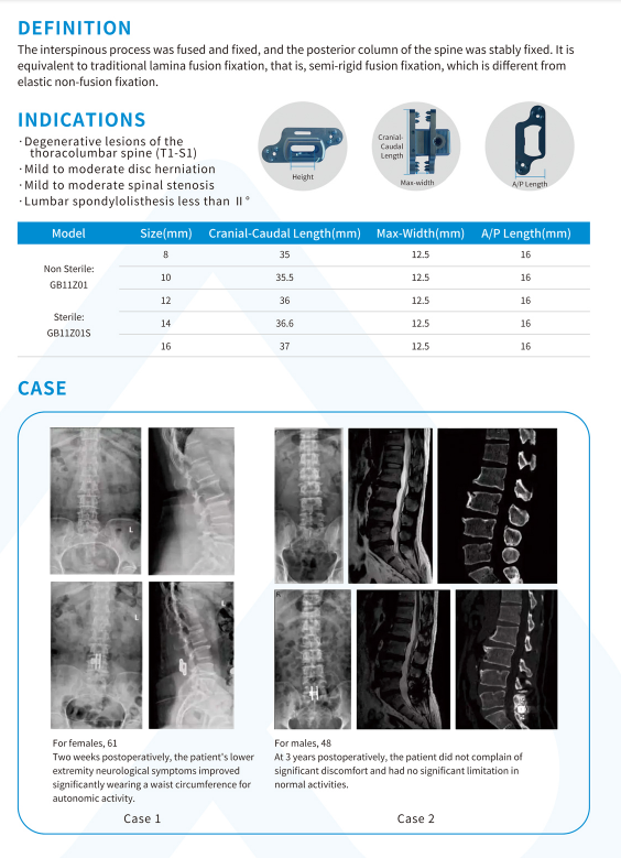 Spacer Details 2