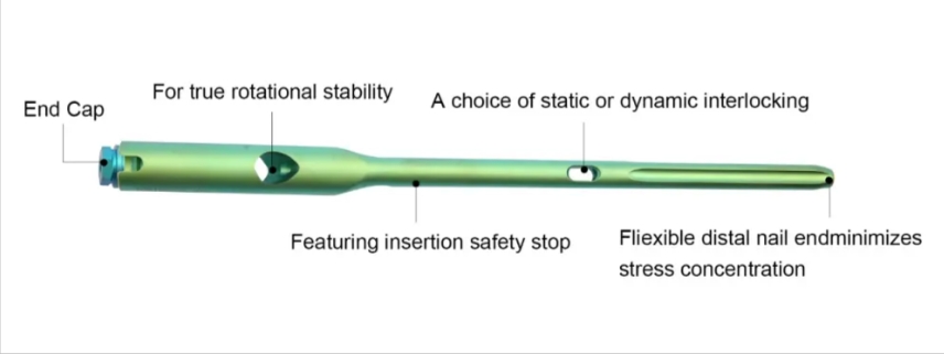 Geasure High Quality Ortopedia Intramedullary Titanium Femoral Pfna Nails  for Orthopedic Surgery