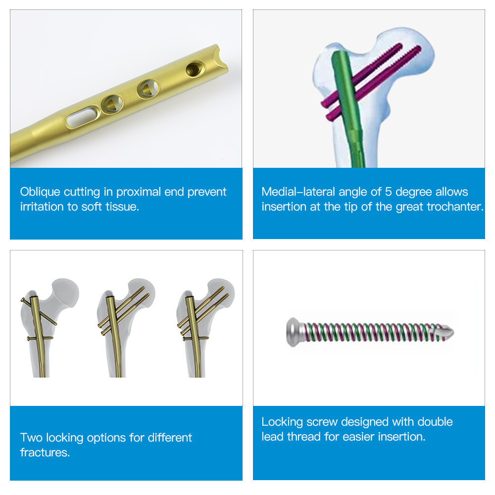 Titanium Alloy Femoral Intramedullary Nail Proximal Femoral Nailing System for Intertrochanteric Fractures