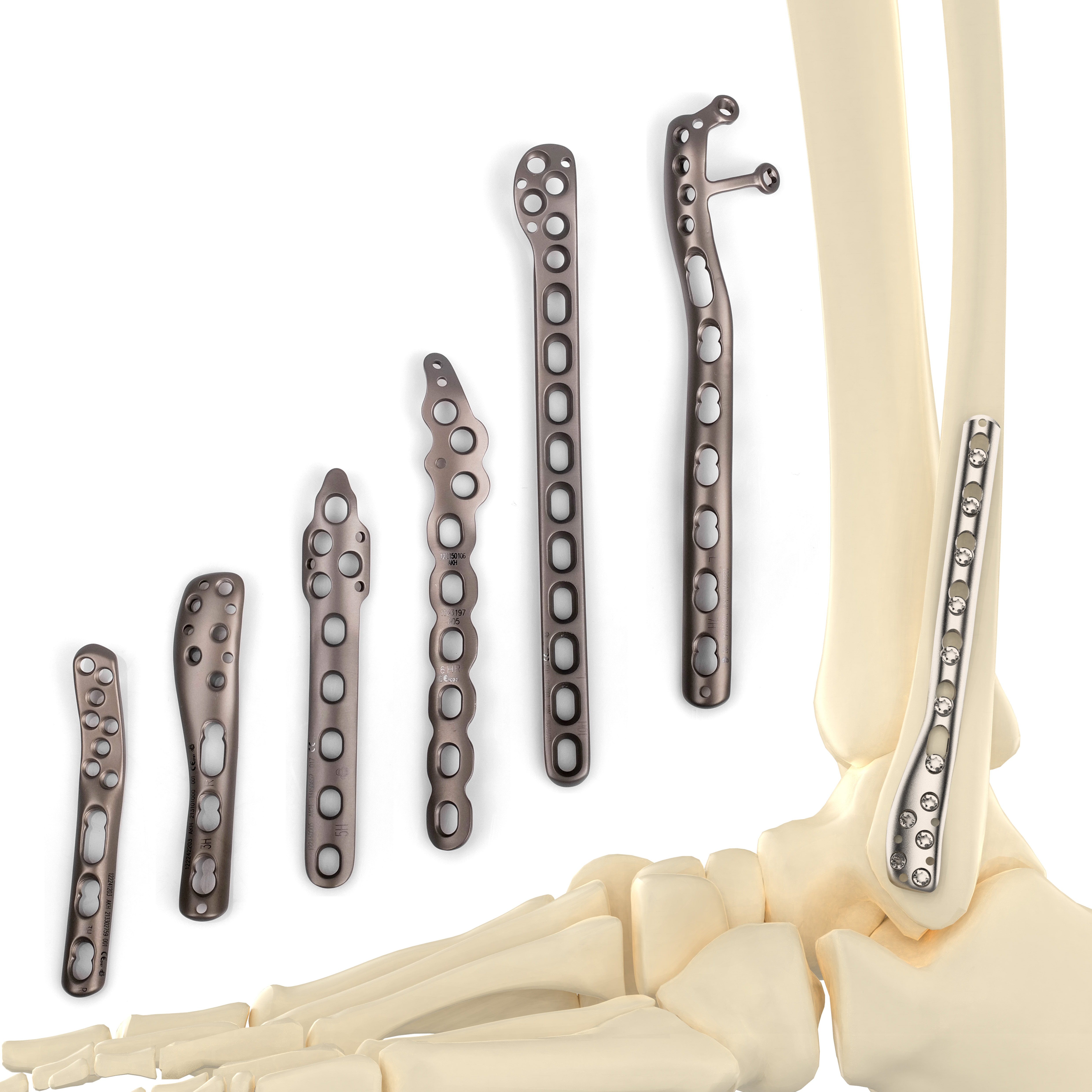 CANWELL Distal Lateral Fibular Locking Plate Orthopedic Implant Small Fragment Titanium Trauma Plate 2.7 3.5 Fibular Plate CE
