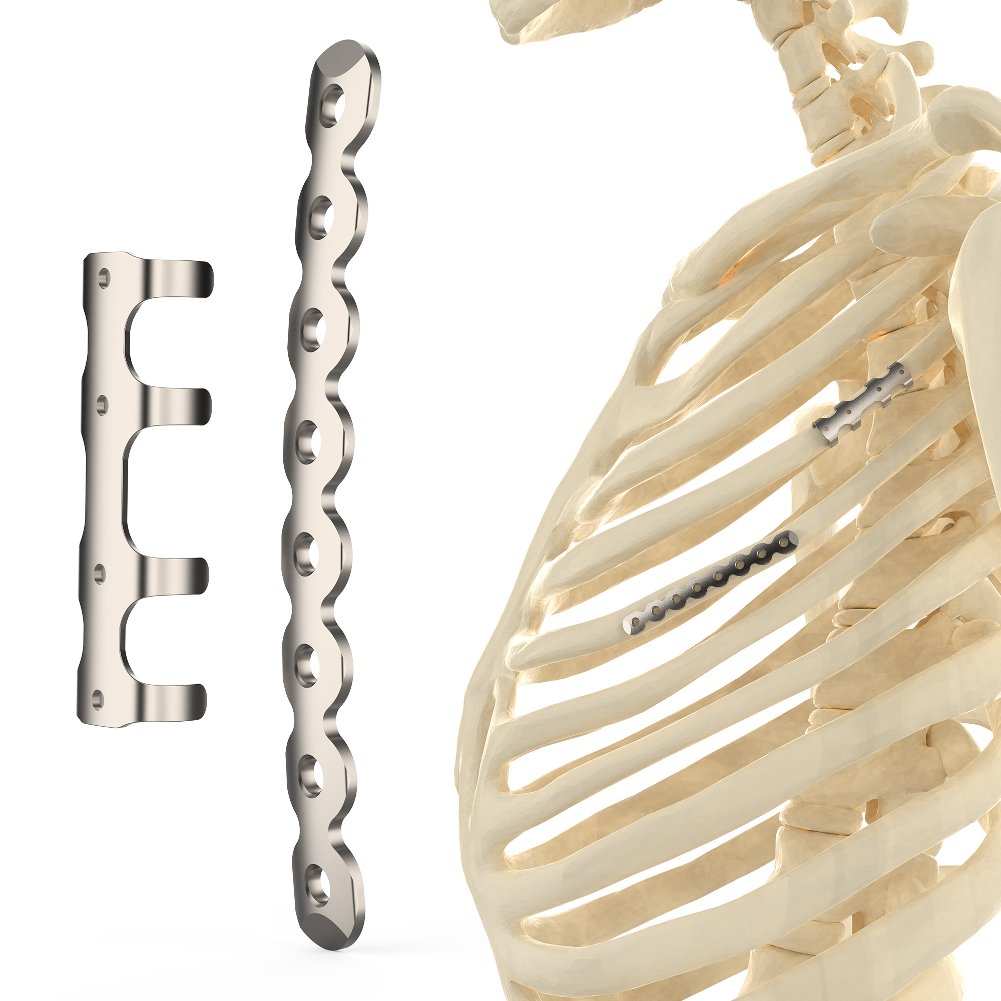 CANWELL Titanium Rib Locking Plate Bone Fixation Orthopedic Trauma Implant for Fracture Surgery CE ISO