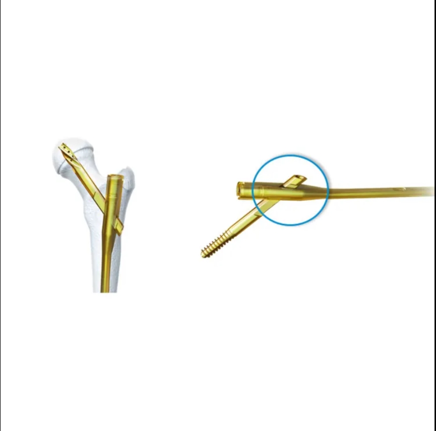 Geasure High Quality Ortopedia Intramedullary Titanium Femoral Pfna Nails  for Orthopedic Surgery