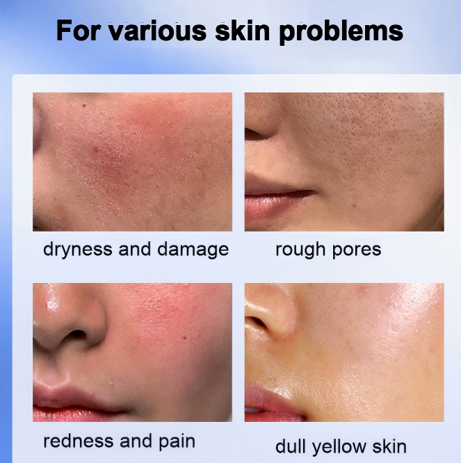 Cosmetic Raw Ectoin 98% Min Multi-functional Skin Repair Active Powder