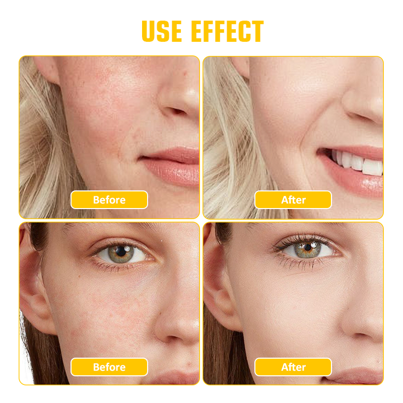 Hyaluronic PDRN Serum, Skincare, Anti-Aging, Skin Repair, Firming, Deep Hydration, Radiance Booster, Wrinkle Care