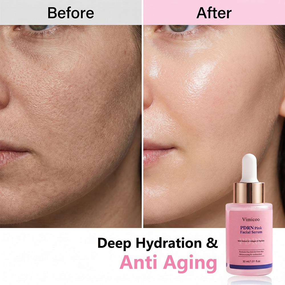 Wholesale Salmon DNA Face Serum PDRN Peptides Retinol Anti-wrinkle Nourishing Firming Skin Care Black Women Facial Essence