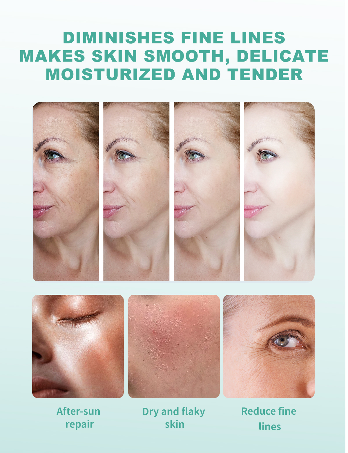 Scar Removing Serum Therapy Protectant Removal Scar Stretch Marks Repair Serum Soothing Relief Burns Scar Repair Serum