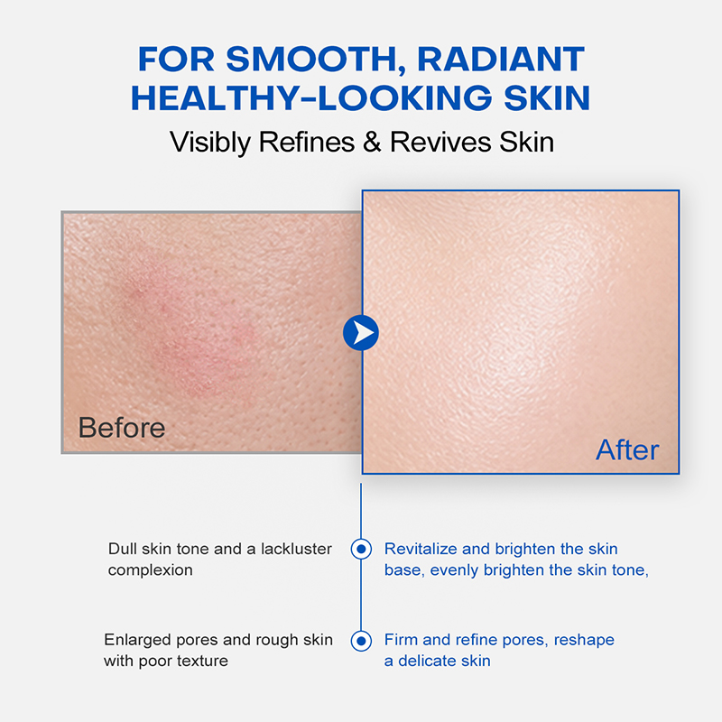 Pdrn Salmon Dna Anti Wrinkle Serum Liquid Microneedling Serum Enhance Shine Bio-Microneedle Anti-Wrinkle Serum Repair Barrier