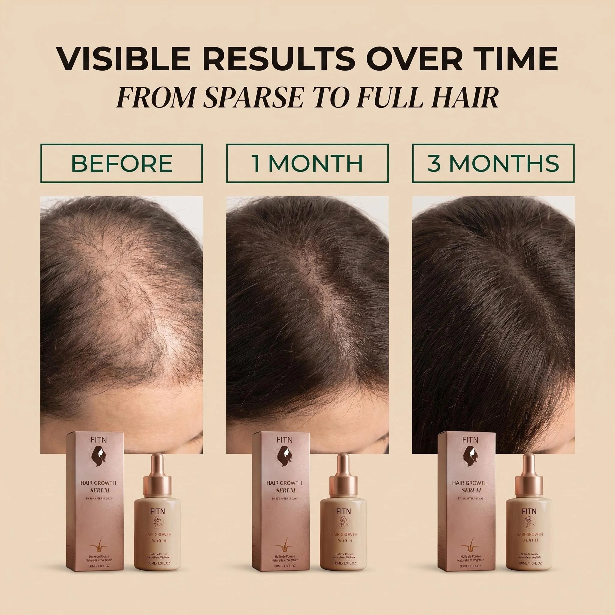 Private Label Rosemary Castor Oil Hair Growth Serum Natural Herbal Nourishing Essence Hair Care Treatment Wholesales Bulk Supply