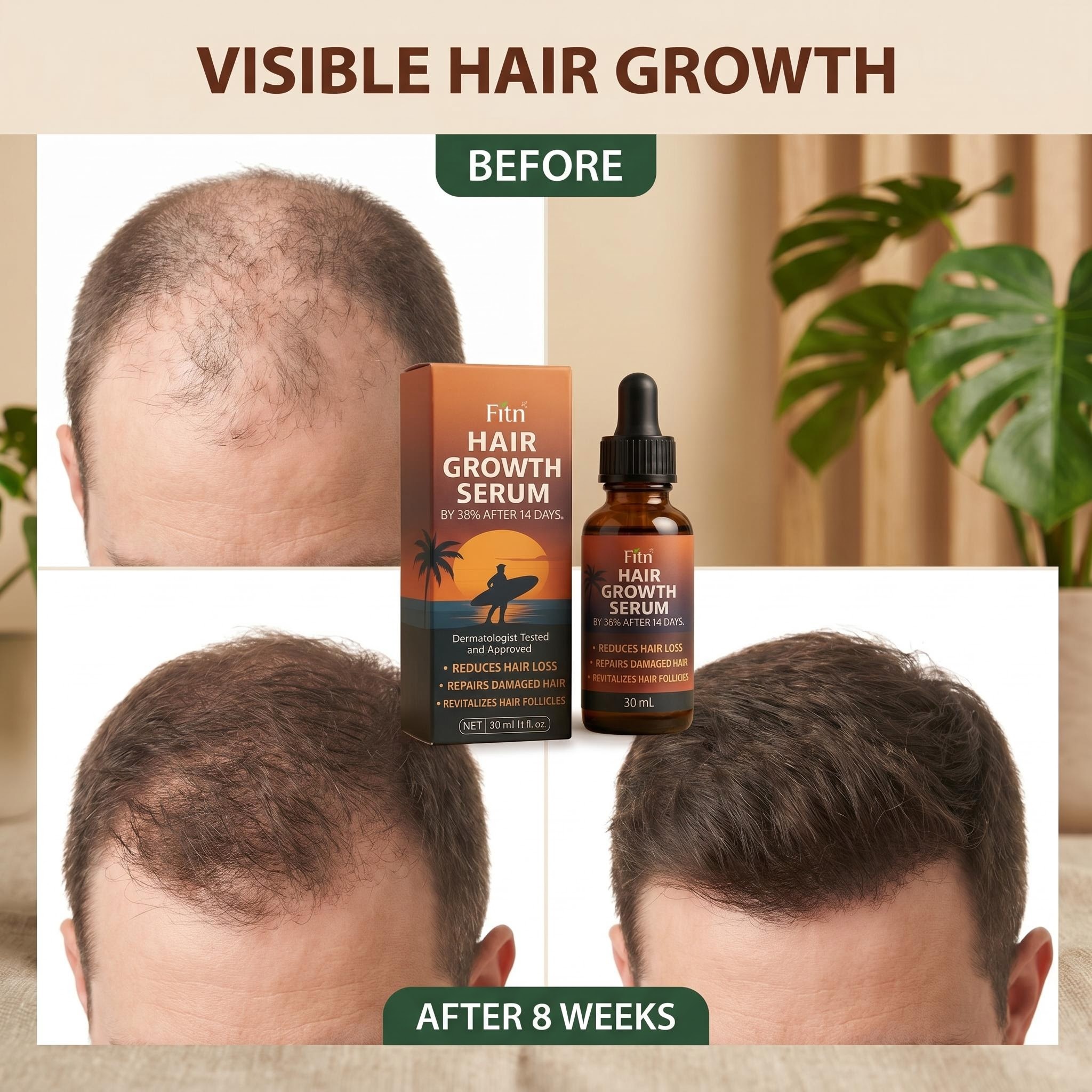 FITN Liposome Peptide Hair Growth Serum Redensyl Capixyl Private Label Scalp Treatment Clinic Grade OEM Hair Loss Manufacturer