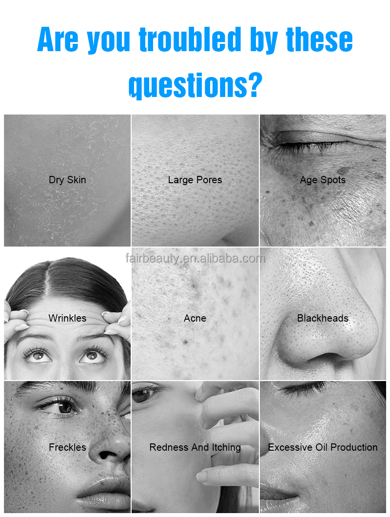 Facial Machine View 2