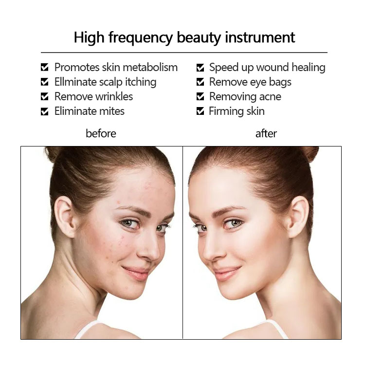 Function Step 5