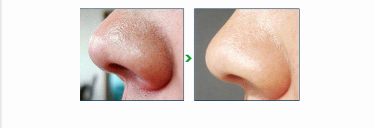 Comparison View 2