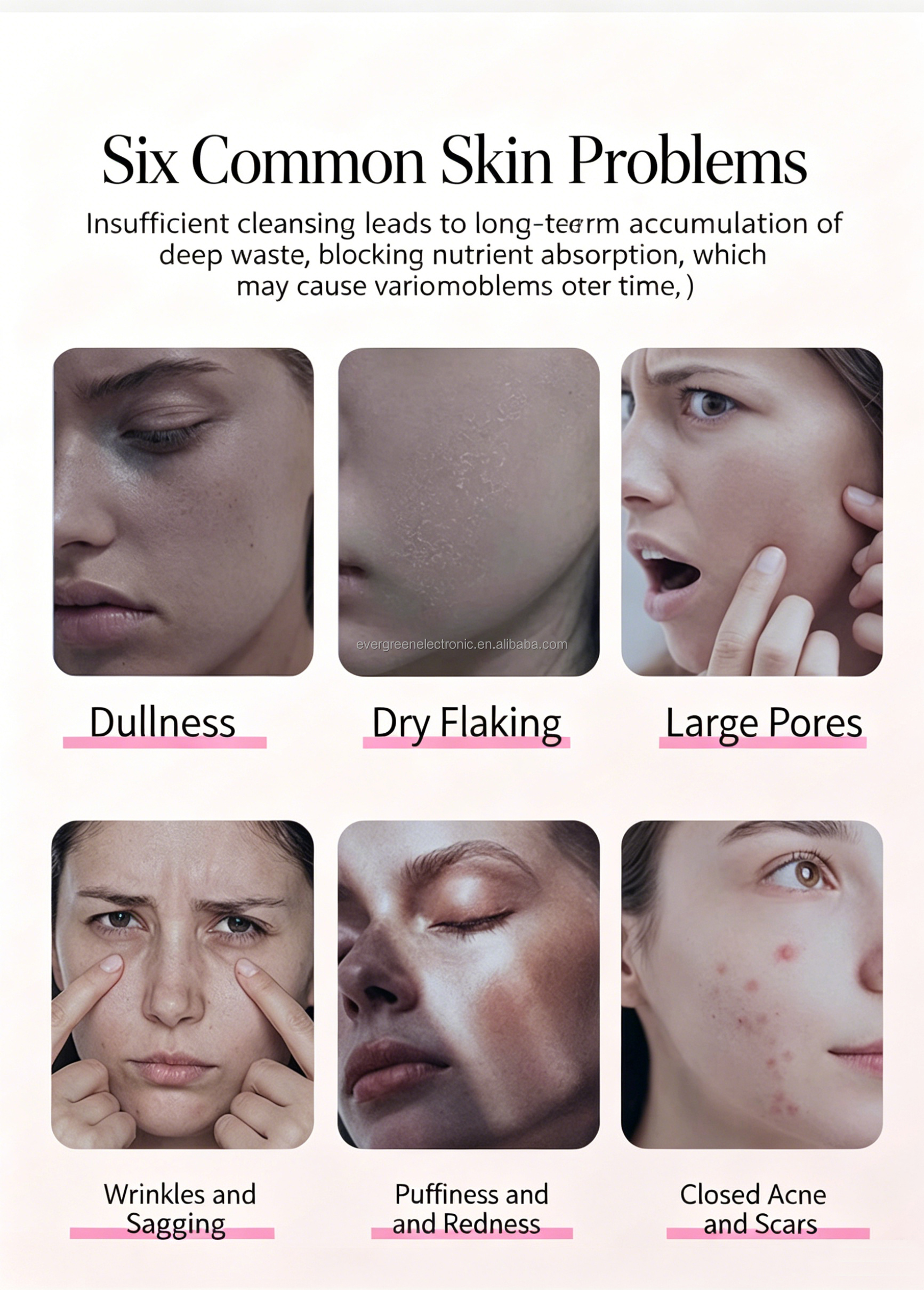 Wholesale Hot and Cold Facial Beauty Device Face Lifting Massager Cold Hot Facial Hammer