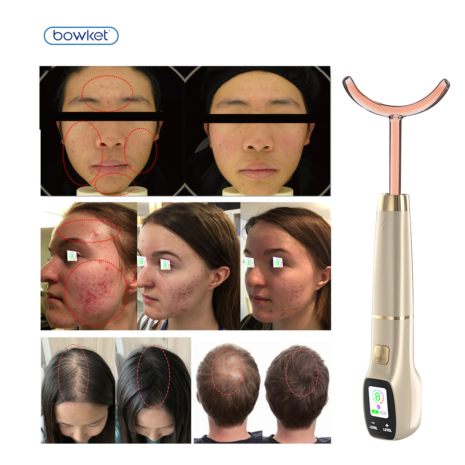 High Frequency Facial Machine Detail 8