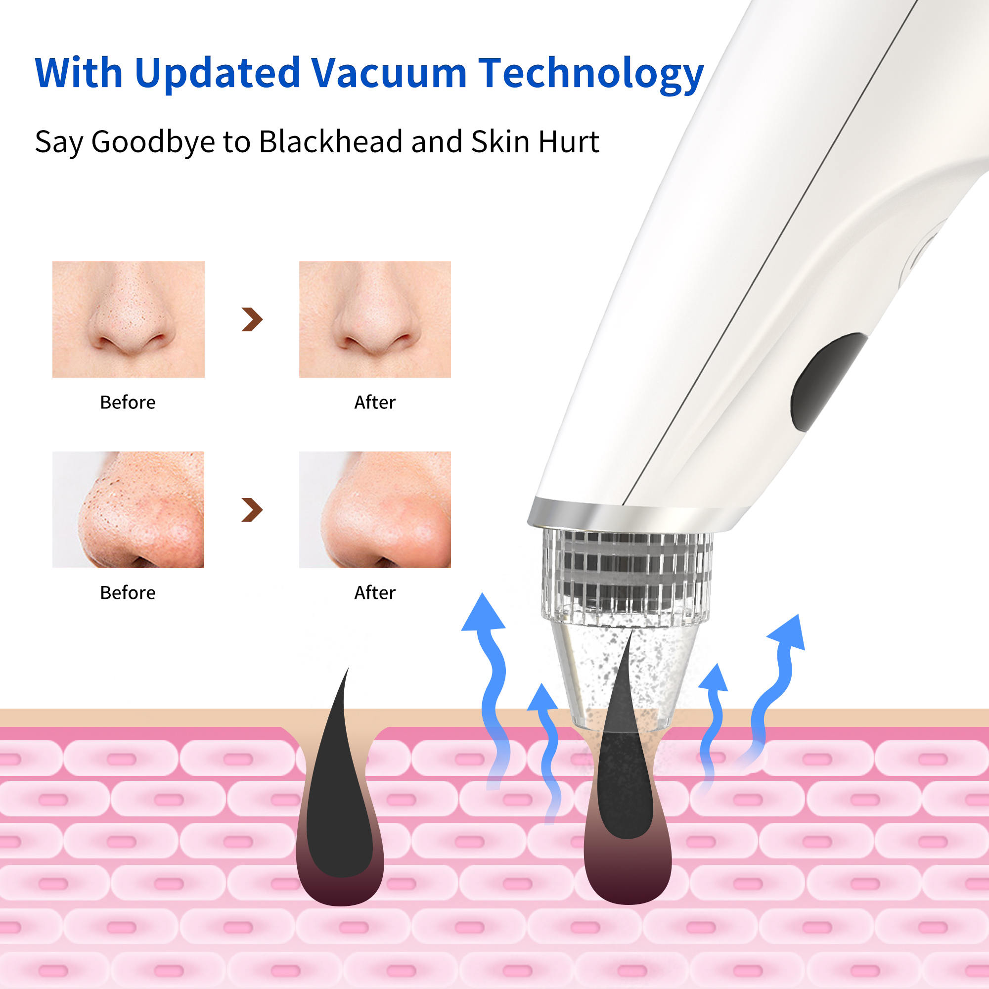 Hot Selling Silicone Hand Held Facial Deep Cleansing Vacuum Black Head Removal Pore Cleaner Rechargeable Beauty Device