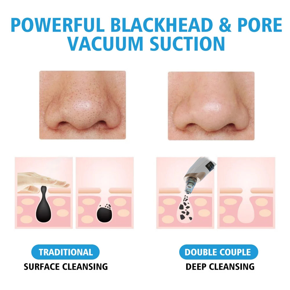 Blackhead Remover Accessories