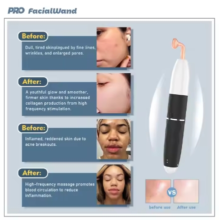 Wholesale Portable Hand Held Electric Acne Treatment Skin Care Facial Wand High Frequency Waterproof ABS Electrode Tubes IT Plug