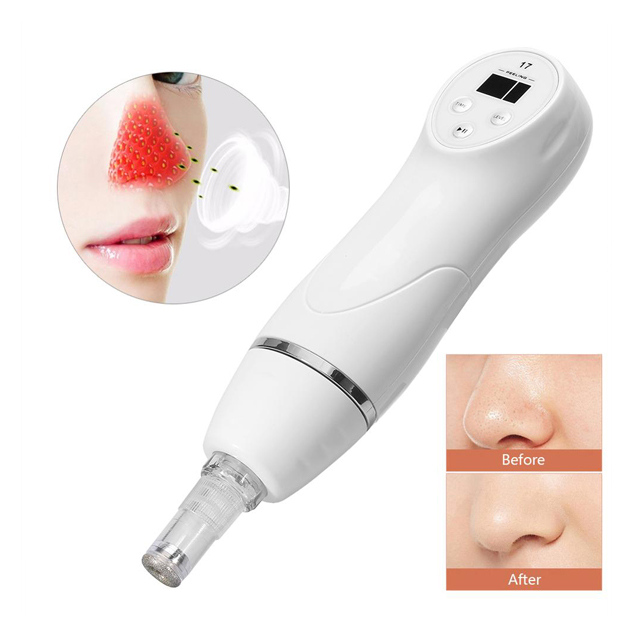 Blackhead Remover Multi-Voltage Vacuum Skin Scrubber with Dermabrasion ABS Material CE Certified for Face Care