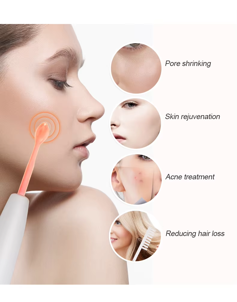 High Frequency Acne Therapy Glass Tube