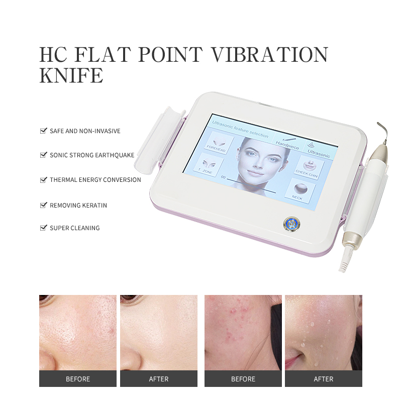 Newly Developed Deep Cleansing Beauty Device Exfoliating Blackhead And Acne Knife Scrubber Targets Clogged Pores On Face Nose